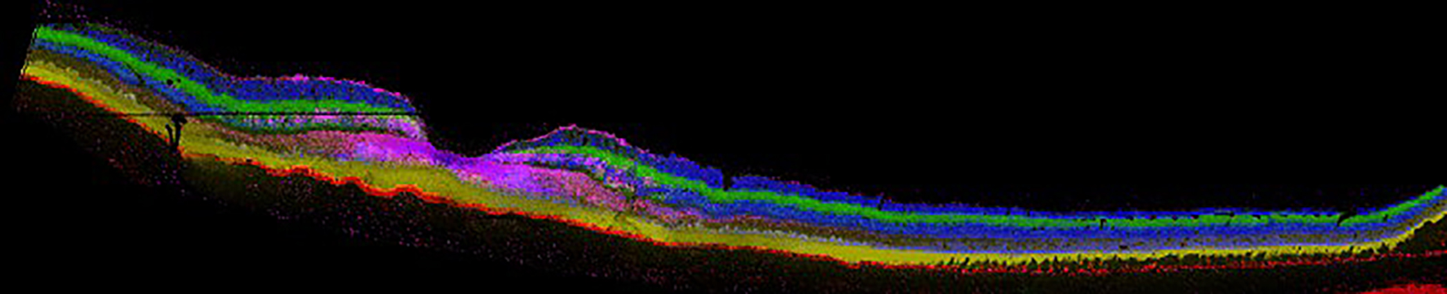 IMS image of human retina with each color representing a layer-specific lipid.