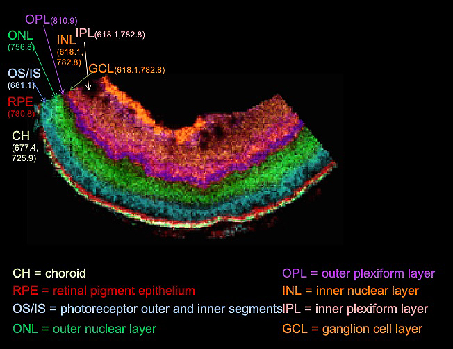 Lipid IMS image showing retina layers containing unique lipid compositions.