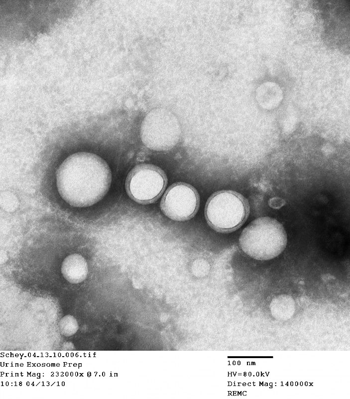 Exosome_micrograph.jpg