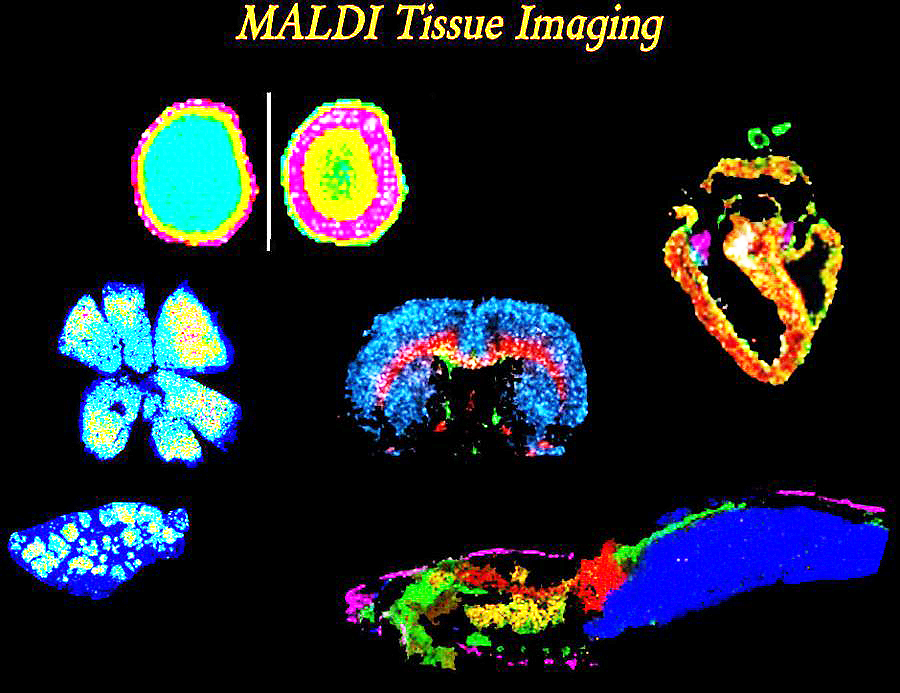 Collage of tissue images acquired in the Schey lab from various projects.