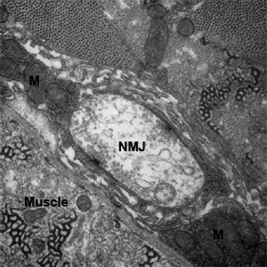 EM of Fly Neuromuscular Junction (NMJ)_(2) copy.png