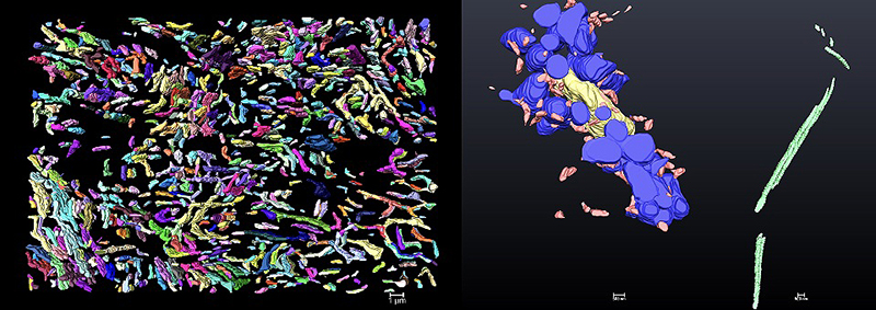 Representative images of 3D reconstruction performed by the Hinton lab. Mitochondrial networks of entire cells may be mapped (left).