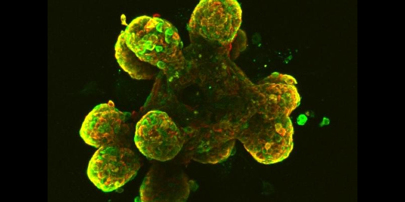 Vanderbilt University