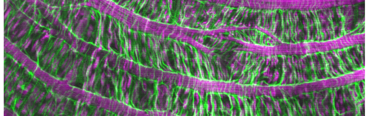 A surface view of the Drosophila gut basement membrane and muscles.