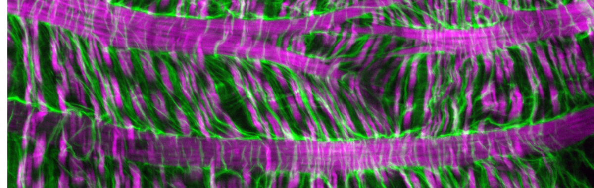 A surface view of the Drosophila gut basement membrane and muscles.